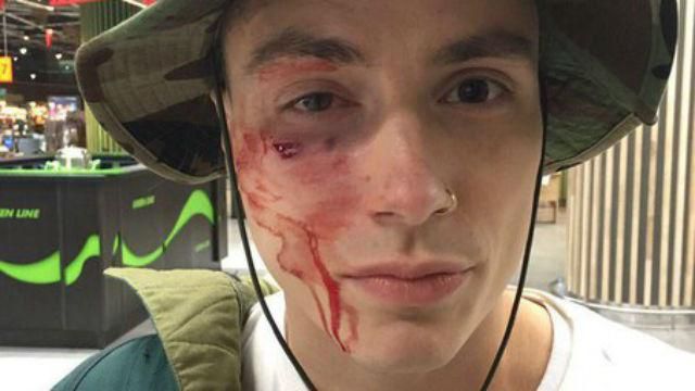 У Києві жорстоко побили відомого музиканта У Києві жорстоко побили відомого музиканта