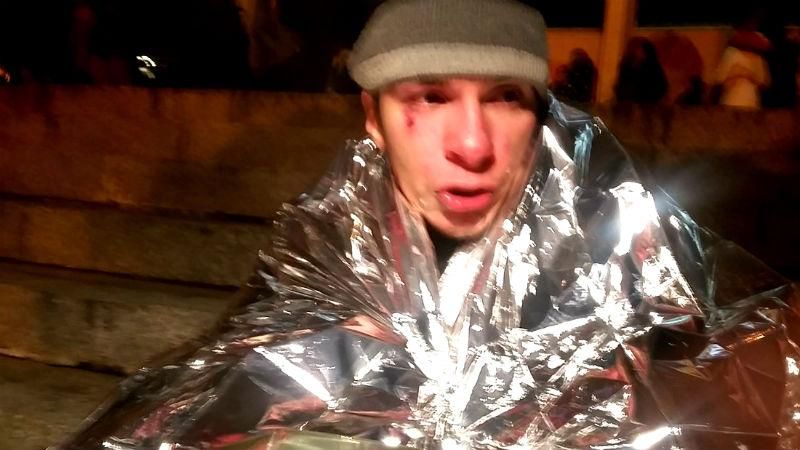 Концерт Потапа і Насті Каменських знову спричинив сутички: є поранені Концерт Потапа і Насті Каменських знову спричинив сутички: є поранені