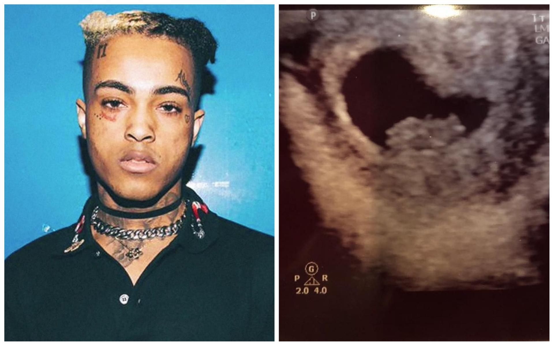 Он оставил нам последний подарок: девушка убитого рэпера XXXTentacion оказалась беременной