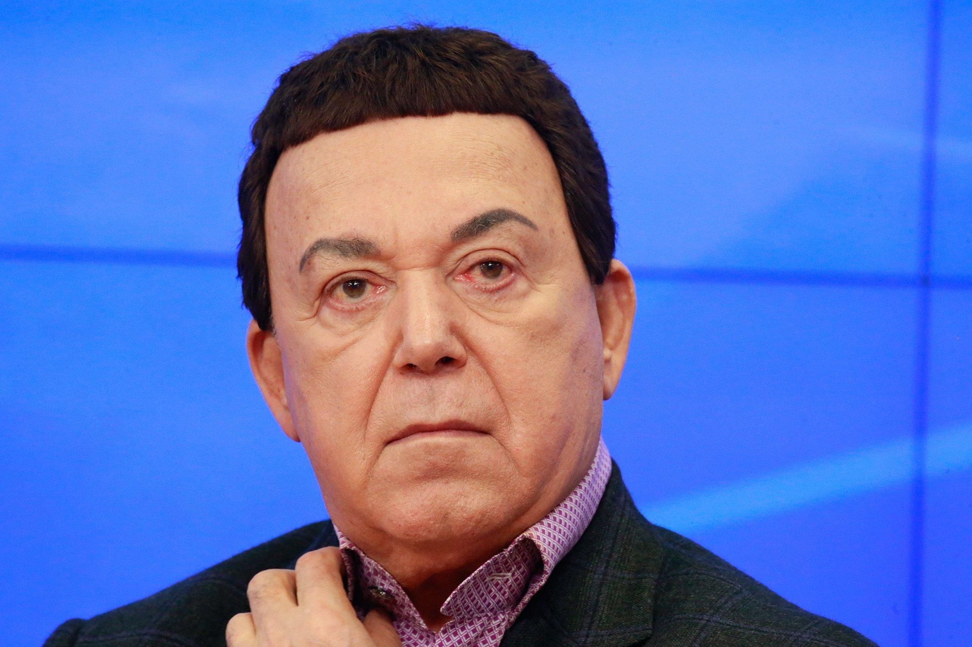 Йосип Кобзон у комі – сапівак впав у кому 28 липня 2018 Йосип Кобзон у комі – сапівак впав у кому 28 липня 2018