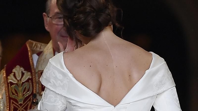 Принцесса Евгения в свадебном платье показала большой шрам: фото