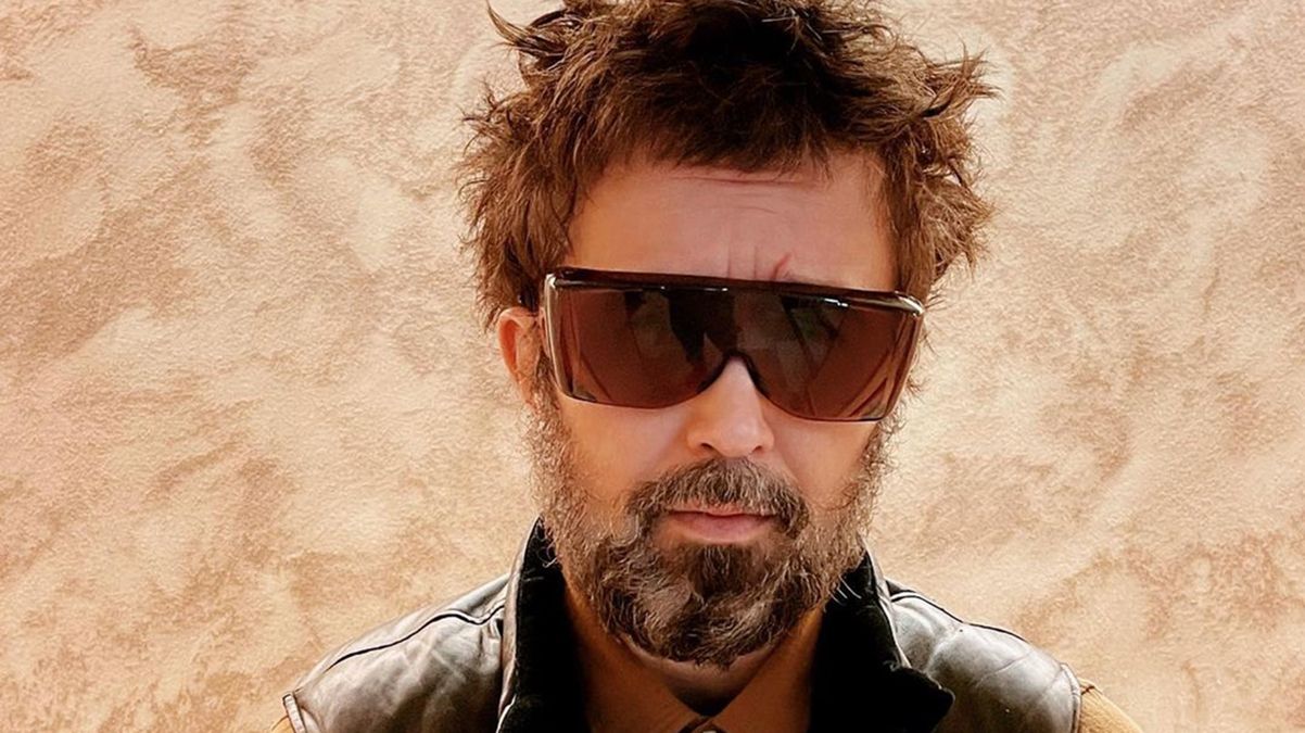 Сергію Бабкіну зробили операцію на оці: відео та результат процедури Сергію Бабкіну зробили операцію на оці: відео та результат процедури