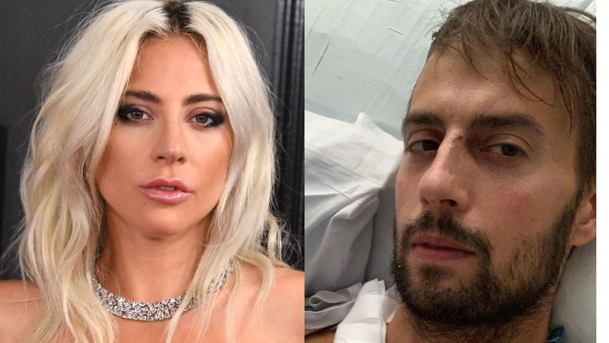 Помічник Леді Гаги отямився та розповів про напад Помічник Леді Гаги отямився та розповів про напад