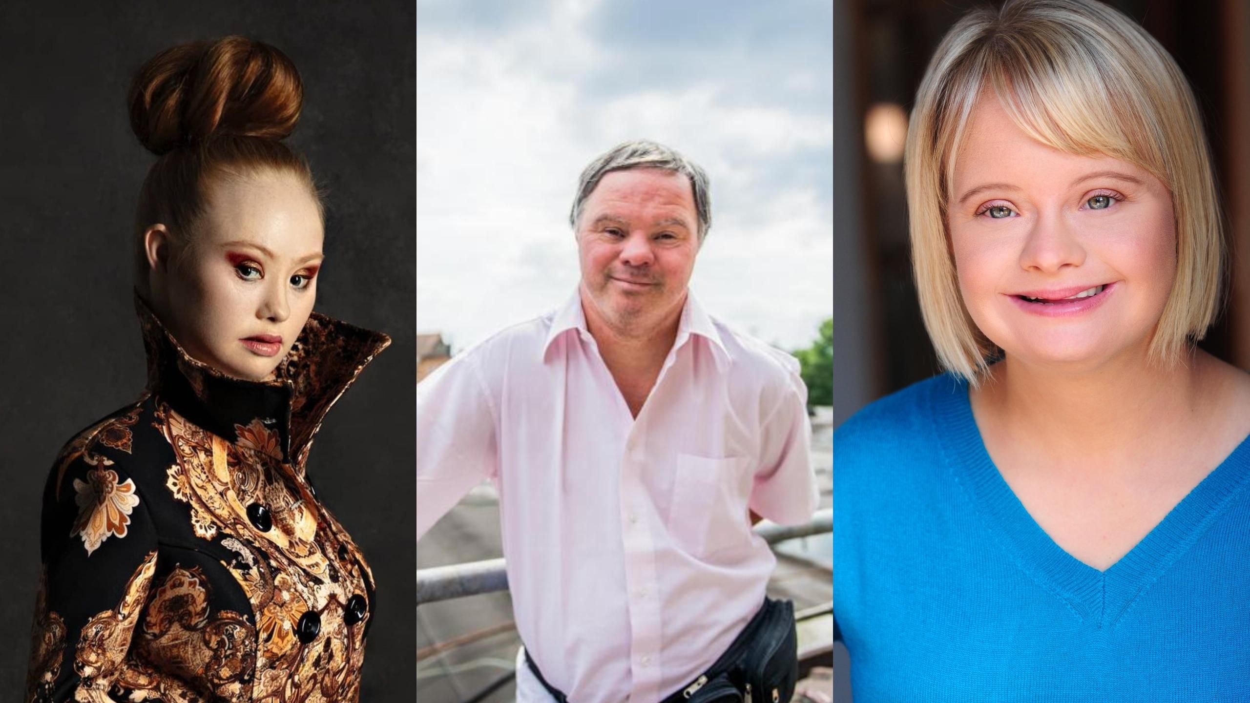 5 зірок із синдромом Дауна: талант попри все 5 зірок із синдромом Дауна: талант попри все