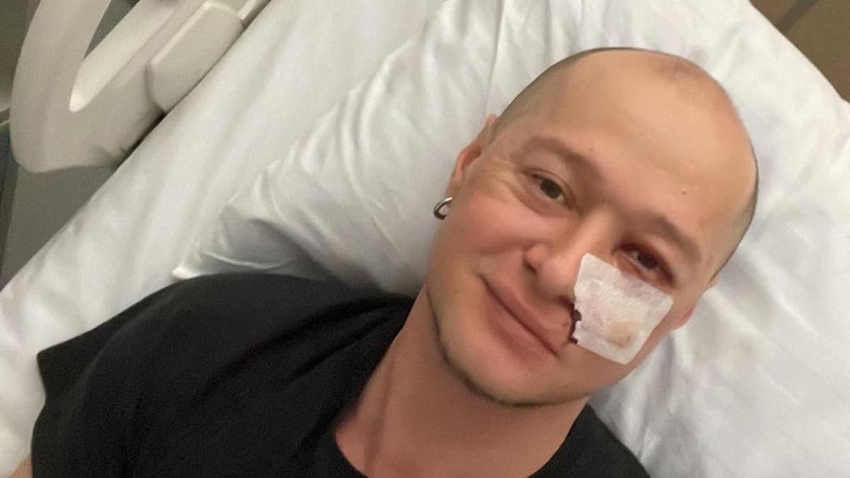 Лідер "Бумбоксу" Хливнюк показався на лікарняному ліжку за два дні після обстрілу - Showbiz