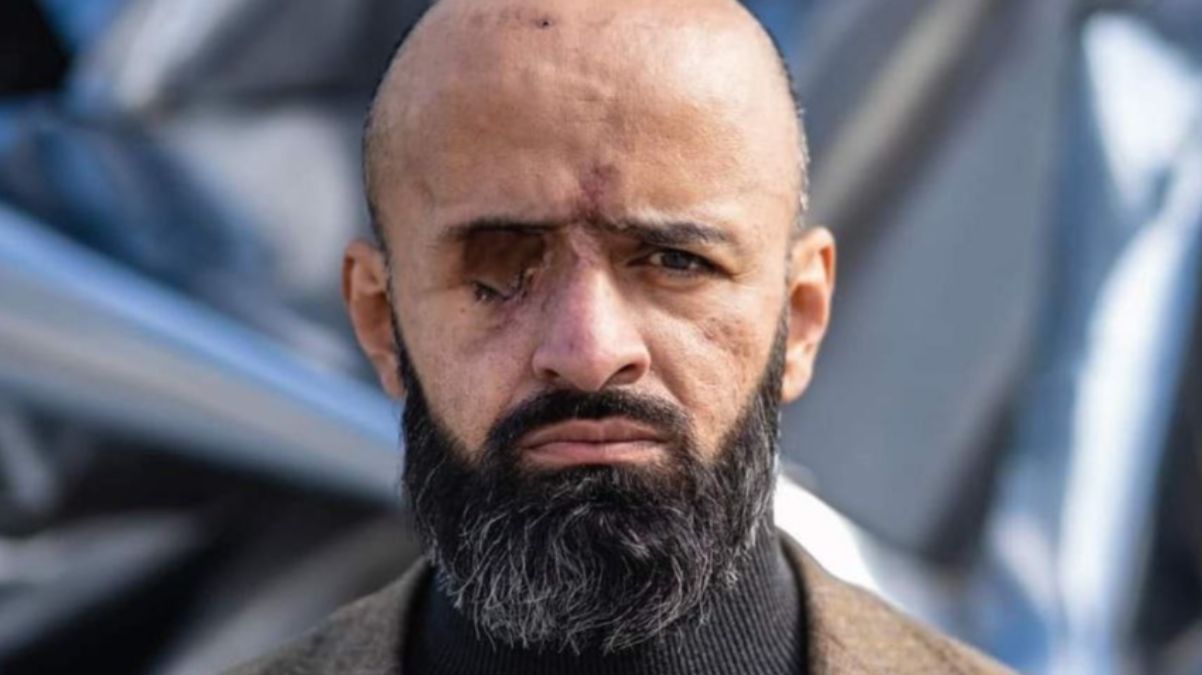 Масі Найєм після важкого поранення – фото для бренду Indposhiv Масі Найєм після важкого поранення – фото для бренду Indposhiv