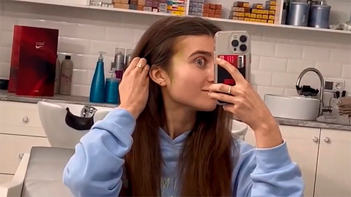 У Jerry Heil гематома на обличчі – як вона виглядає після падіння – відео