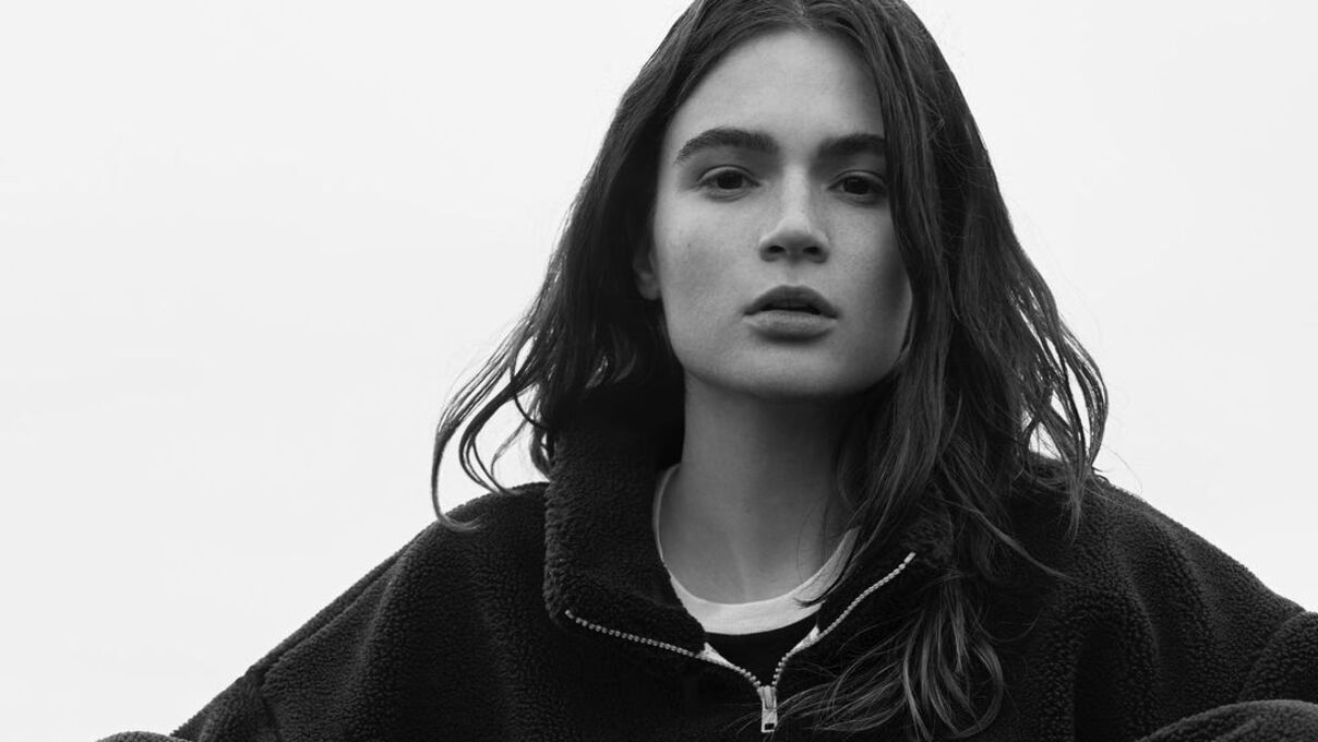 Обраниця Володимира Дантеса зробила пластичну операцію - що змінила Обраниця Володимира Дантеса зробила пластичну операцію - що змінила