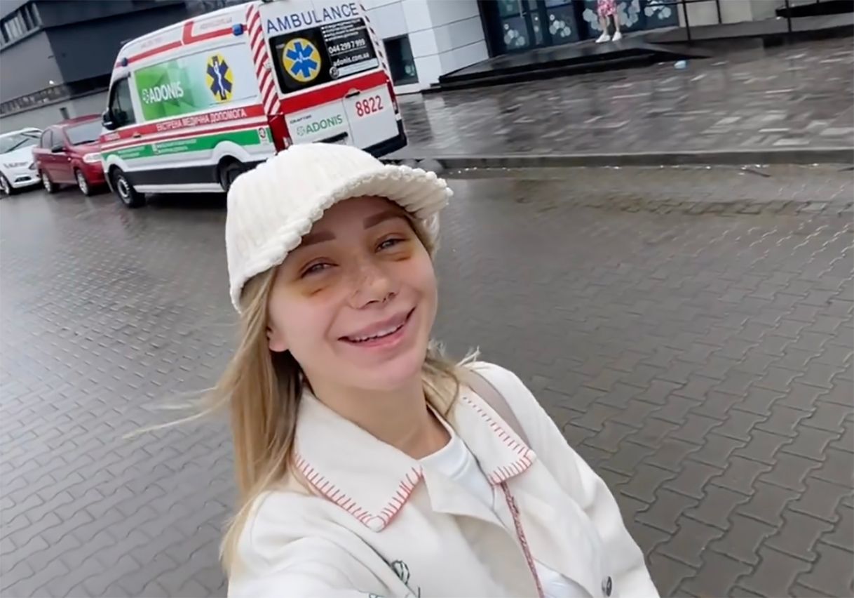 Катерина Реп'яхова показалася після ринопластики Катерина Реп'яхова показалася після ринопластики