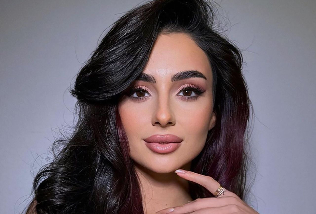 Анна Тринчер увеличила губы Анна Тринчер увеличила губы