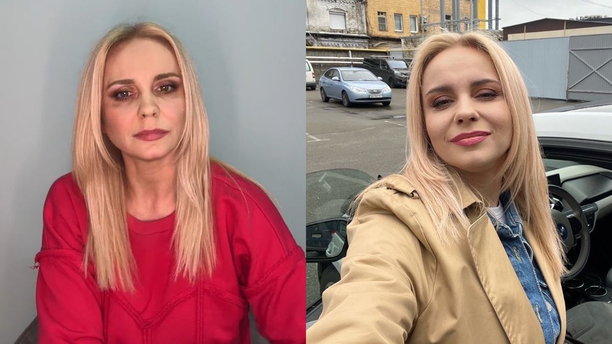 Лілія Ребрик відповіла на критику через синці під очима - фото Лілія Ребрик відповіла на критику через синці під очима - фото