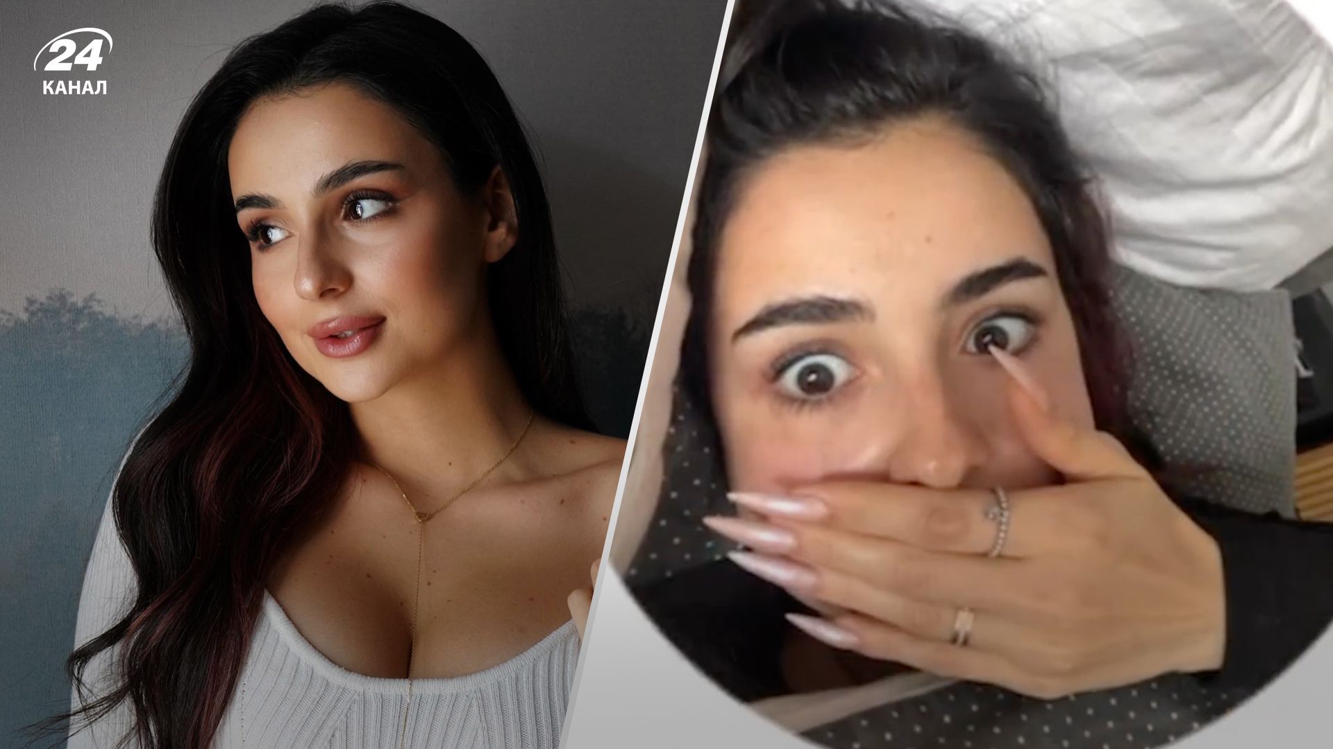 Анна Тринчер показала себя после 5-часовой операции Анна Тринчер показала себя после 5-часовой операции