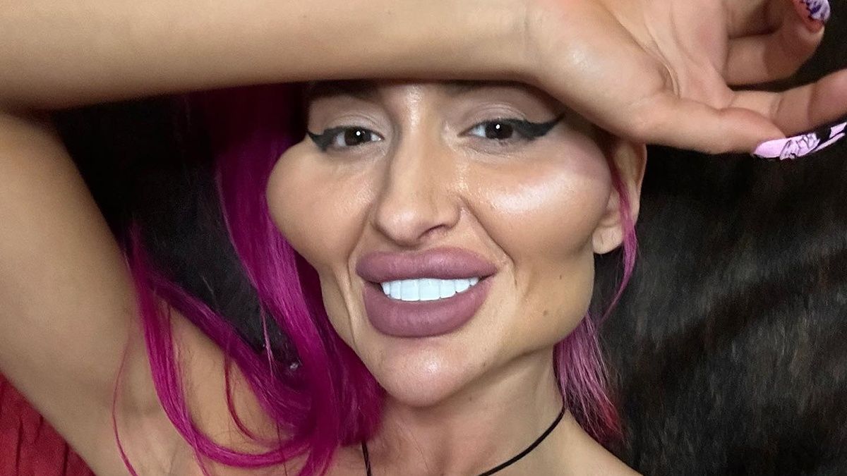 Украинка с самыми большими скулами показала себя до пластики – как она выглядела Украинка с самыми большими скулами показала себя до пластики – как она выглядела